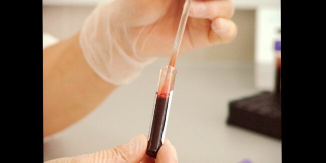 2024-08-08 Depresion