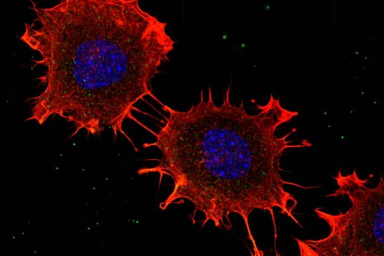 2024-11-28 – proteina