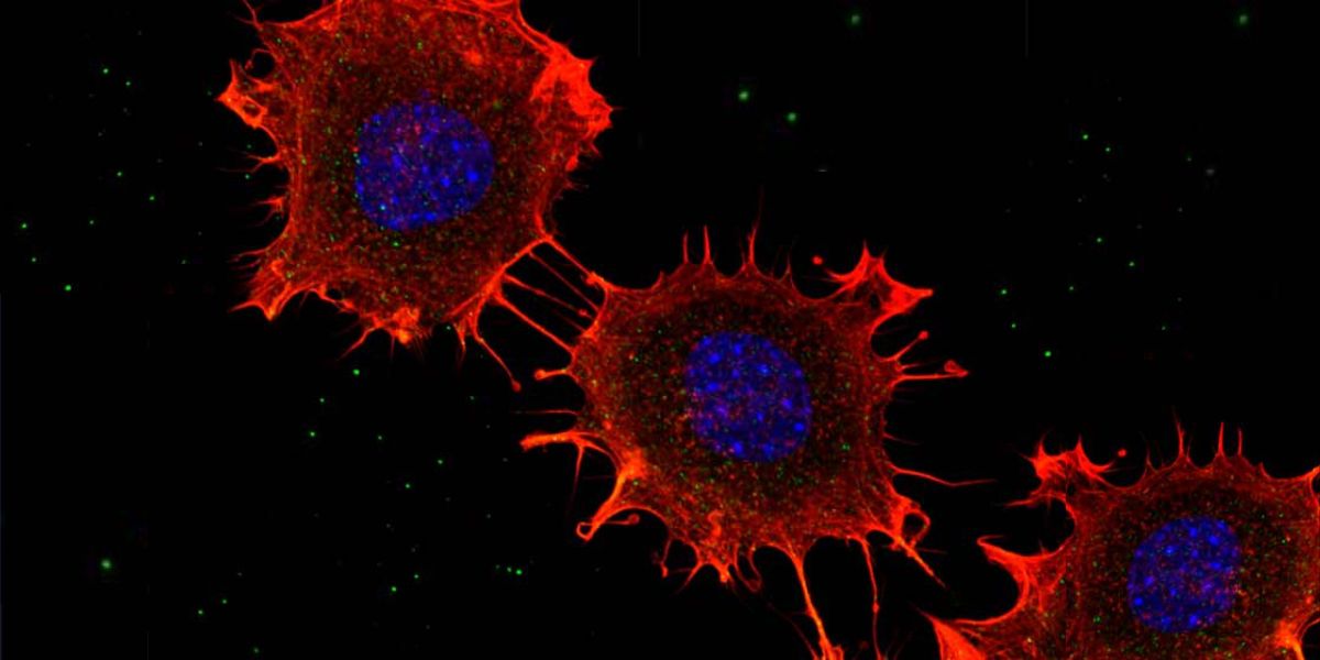 2024-11-28 – proteina