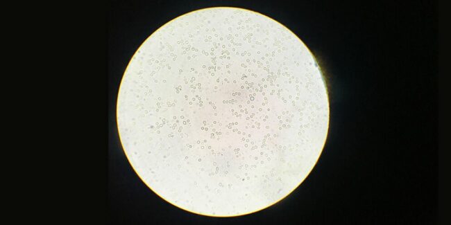 2025-01-27 – vacuna chagas