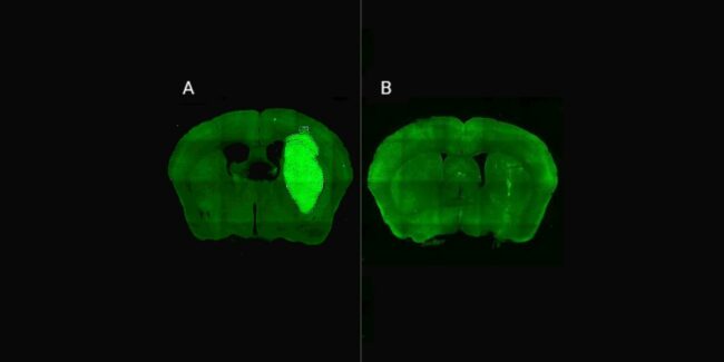 25.08.11 – gliblsatoma